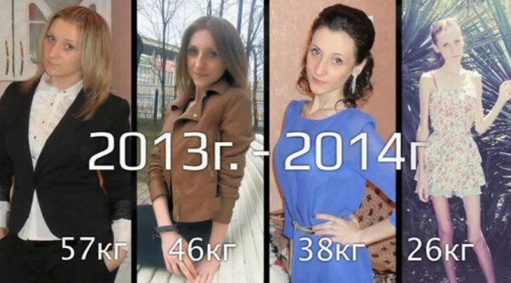 В 19 лет — 26 kг, как изменилась девушка спустя 5 лет после «Пусть говорят»